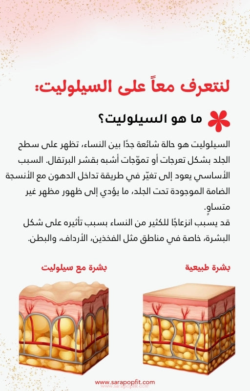 دليلك للتعرف على السيلوليت والوذمة الشحمية والتخلص منهما