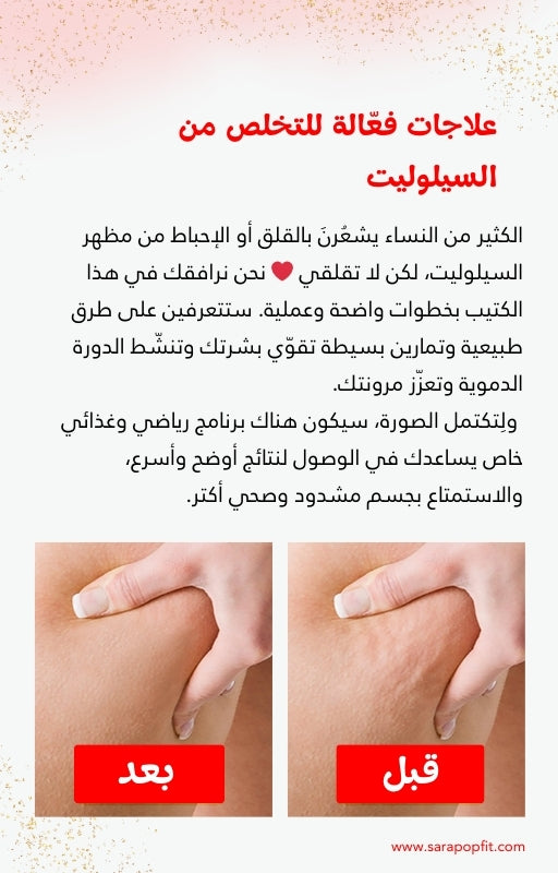 دليلك للتعرف على السيلوليت والوذمة الشحمية والتخلص منهما